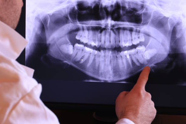 Best Emergency Treatment for Dental Infections or Abscesses in Alamo, TN