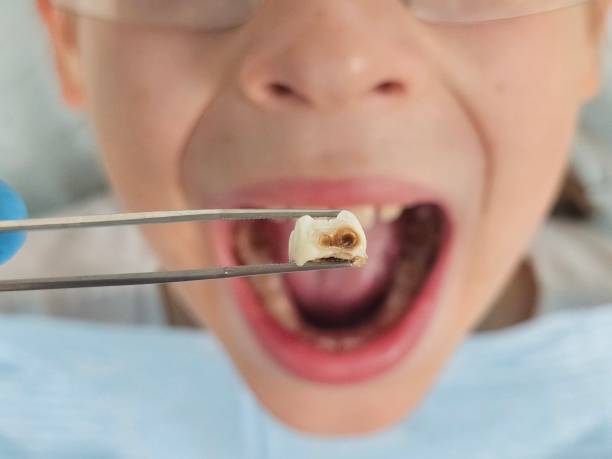 Best Pediatric Emergency Dentist in Alamo, TN