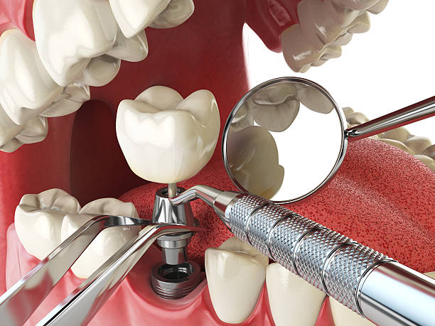 Best Urgent Care for Lost Fillings or Crowns in Alamo, TN