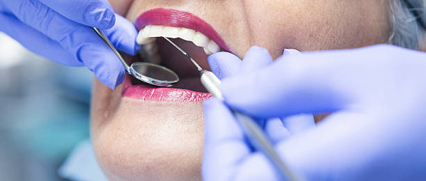 Best Emergency Wisdom Teeth Removal in Alamo, TN